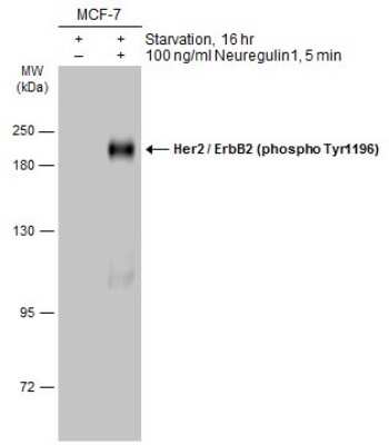 Western Blot: ErbB2/Her2 [p Tyr1196] Antibody [NBP3-13268]